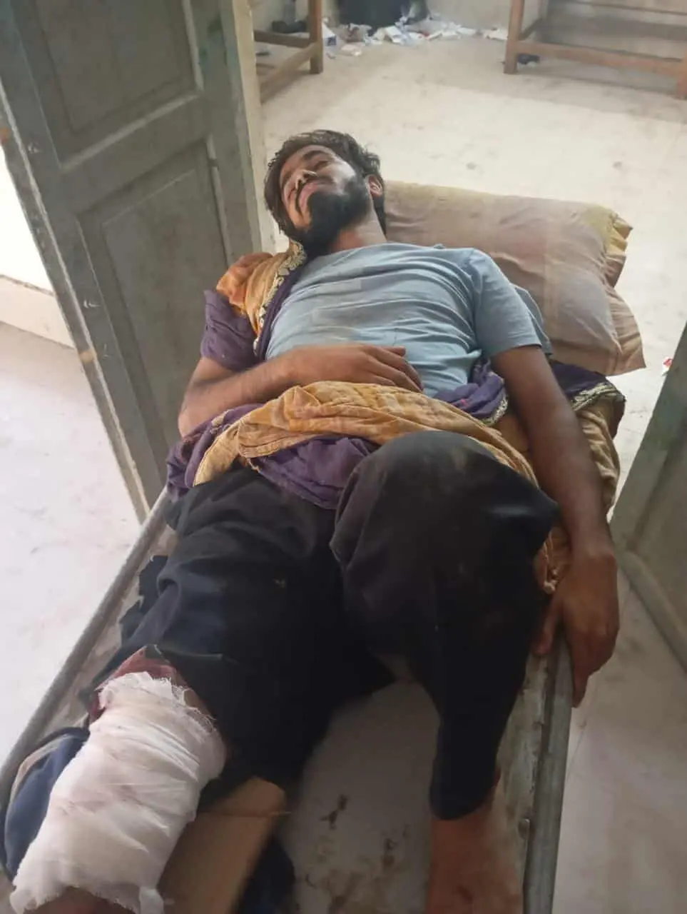 ফটিকছড়িতে গাছ চোরদের হামলায় রেঞ্জারসহ আহত - ৫