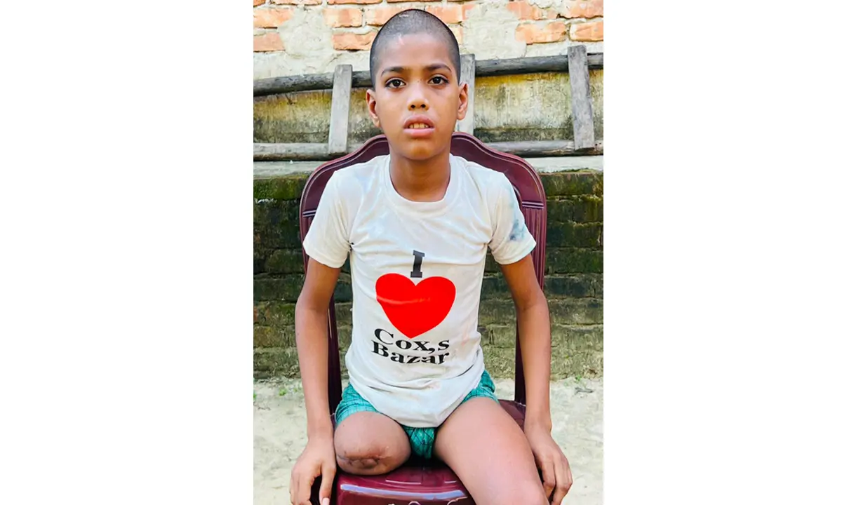চুল কাটতে বের হওয়া রায়হান ফিরল এক পা হারিয়ে