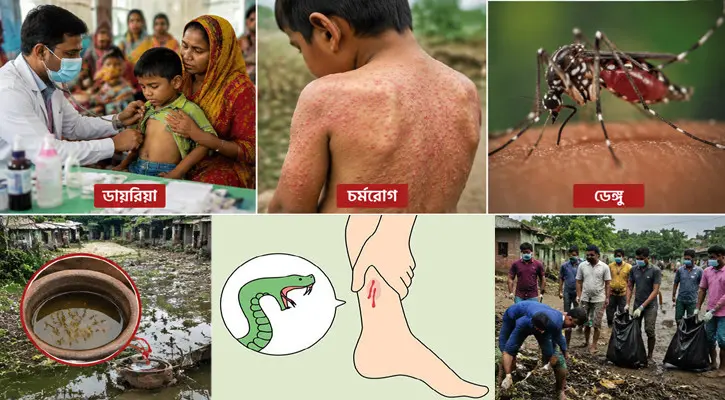 বন্যার পানি নামার পর বাড়ছে ডায়রিয়া-চর্মরোগ, সঙ্গে ডেঙ্গু