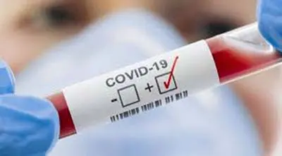 করোনা: চট্টগ্রামে ২৪ ঘণ্টায় শনাক্ত ৩ জন