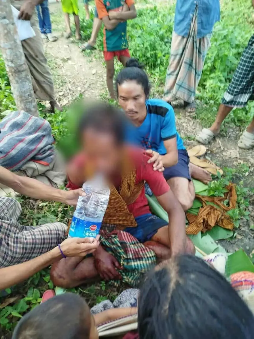 বান্দরবানের রুমায় বন্য ভাল্লুকের আক্রমণে জুমচাষি আহত