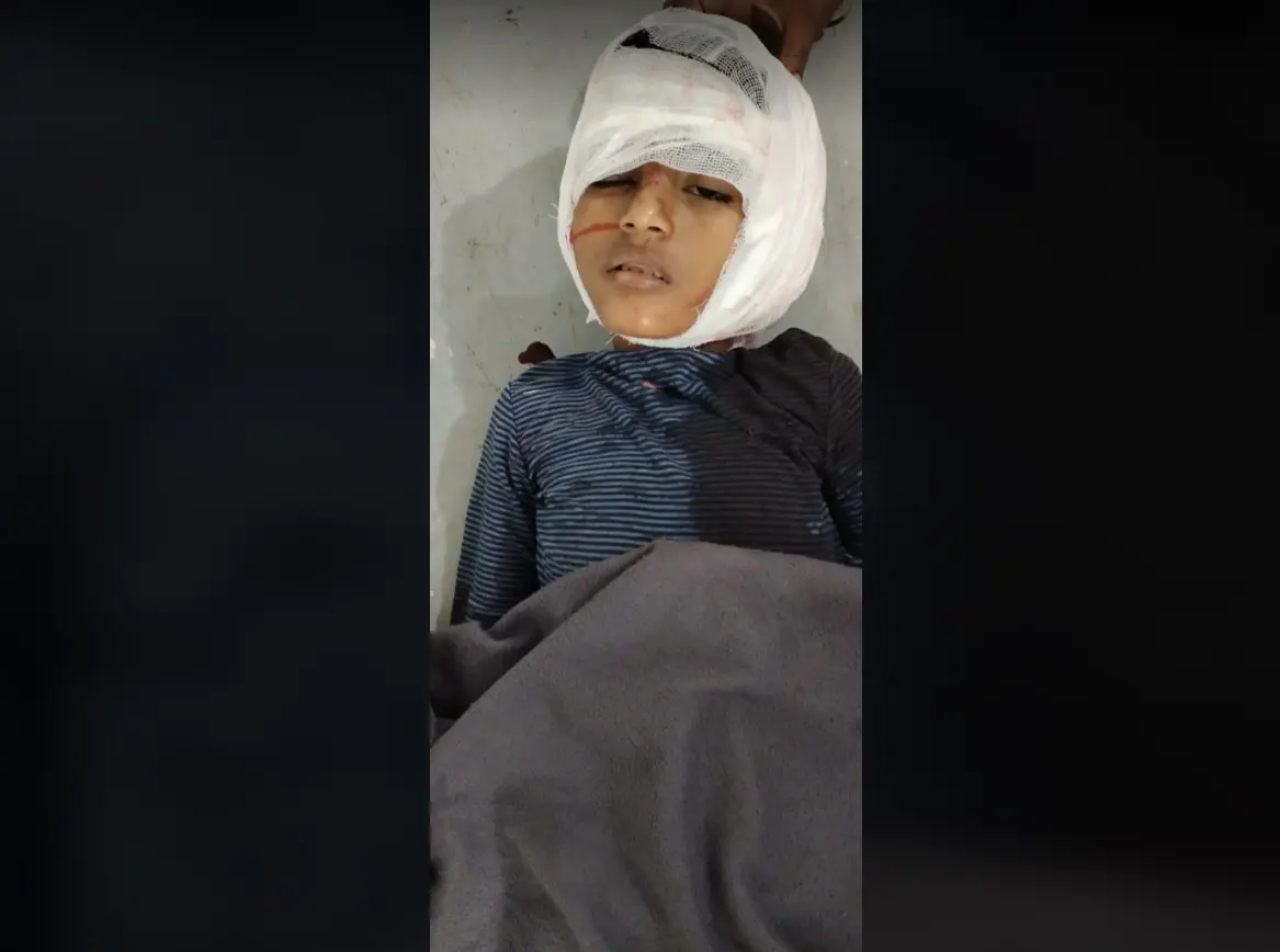 সাতকানিয়ায় গাছ কাটার সময় শ্রমিকের অসতর্কতায় শিশুর মৃত্যু