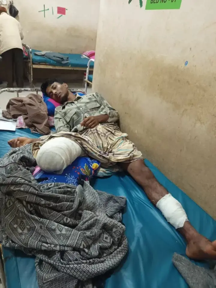 ঈদগাঁওয়ে লবণ কারখানার মেশিনে শ্রমিকের পা বিচ্ছিন্ন