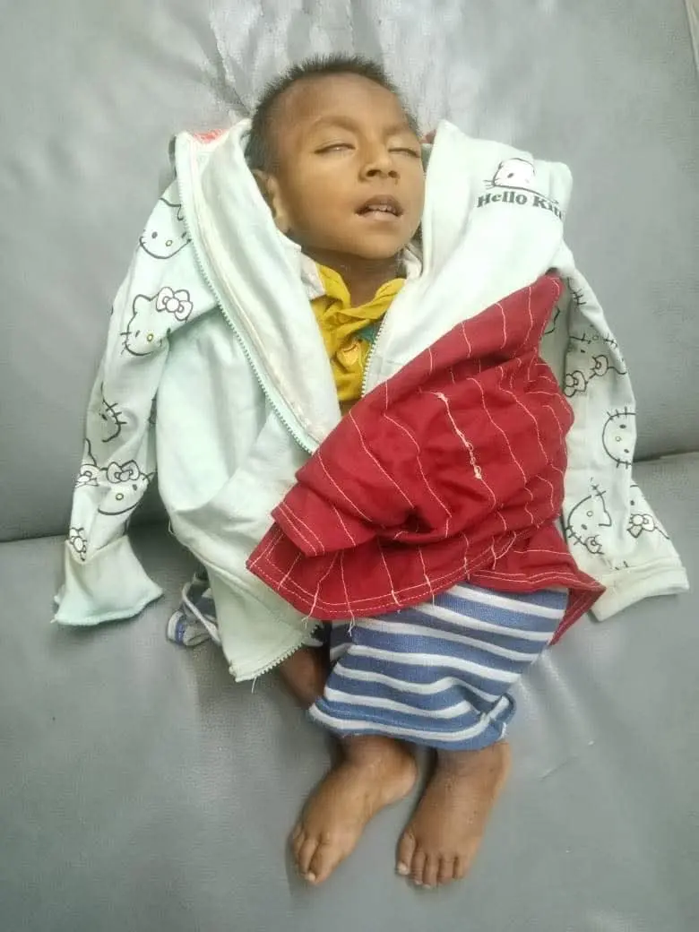 আনোয়ারায় উদ্ধার হওয়া সেই শিশুর মৃত্যু, অসুস্থ বোন হাসপাতালে