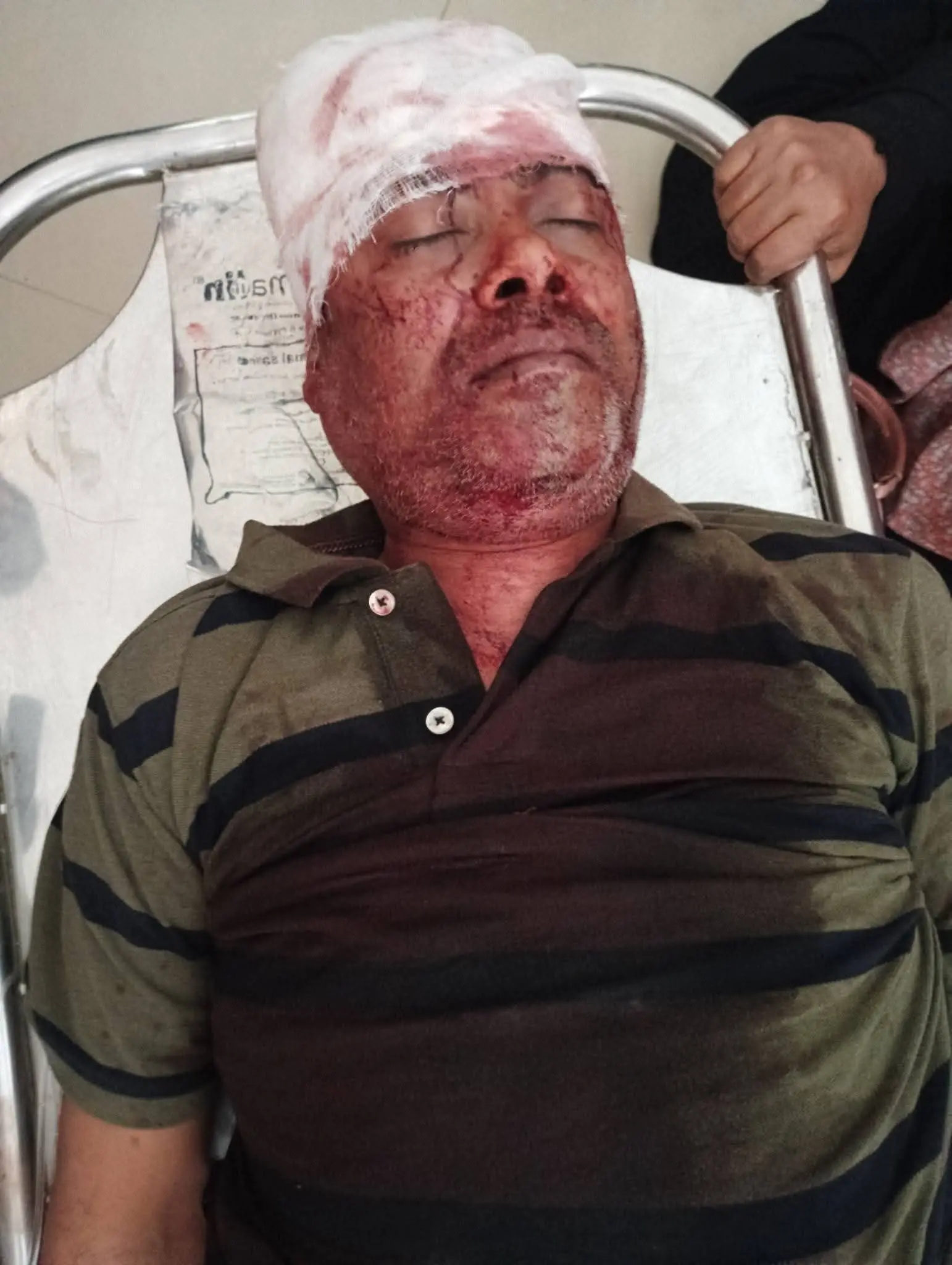 চকরিয়ায় বেপরোয়া টমটমের ধাক্কায় ব্যবসায়ীর মর্মান্তিক মৃত্যু