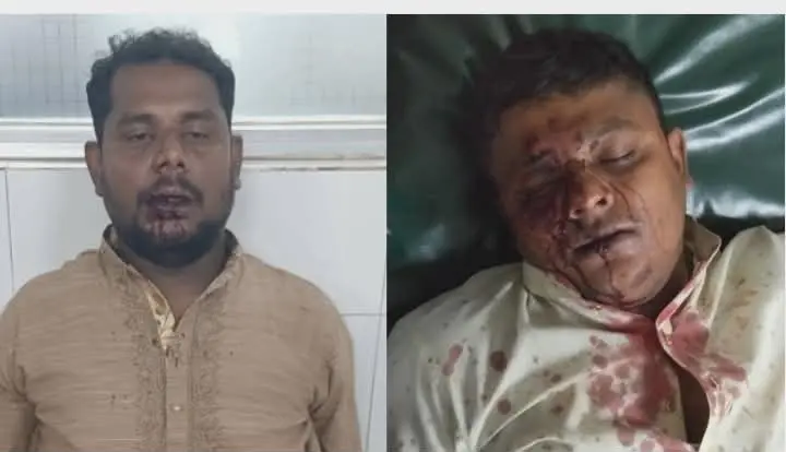 বারো আউলিয়া নগর নিয়ে বিরোধ, দুই পক্ষের সংঘর্ষে আহত ৫