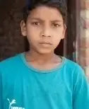 সাতকানিয়া ​এতিম শিশু রাফির জীবন বাঁচাতে মানবিক সহায়তার আবেদন