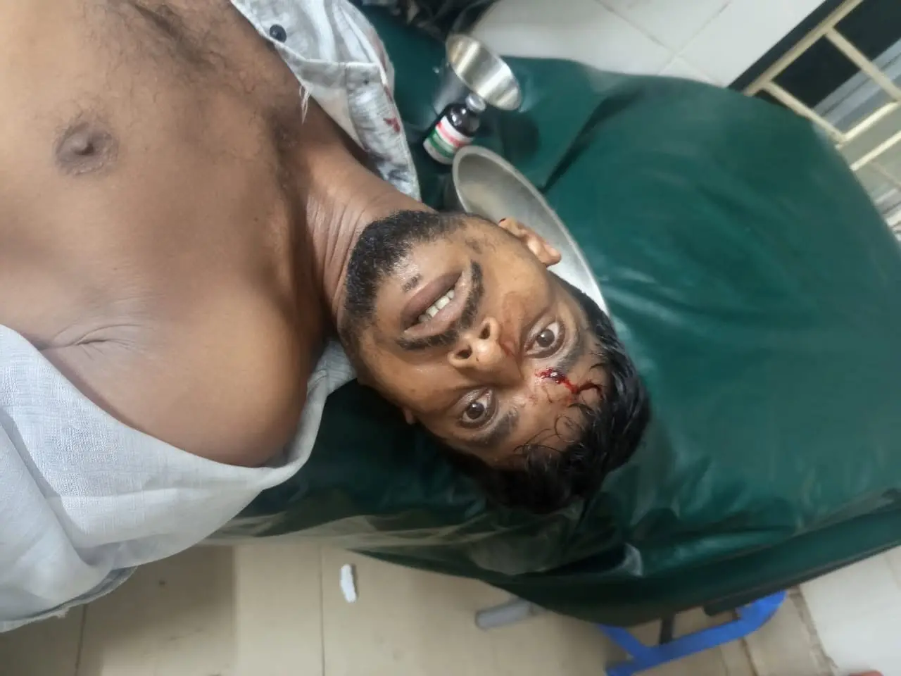 বাঁশখালীর মনকিচরে গান-বাজনা বন্ধ করতে বলায় হামলা, আহত ৩
