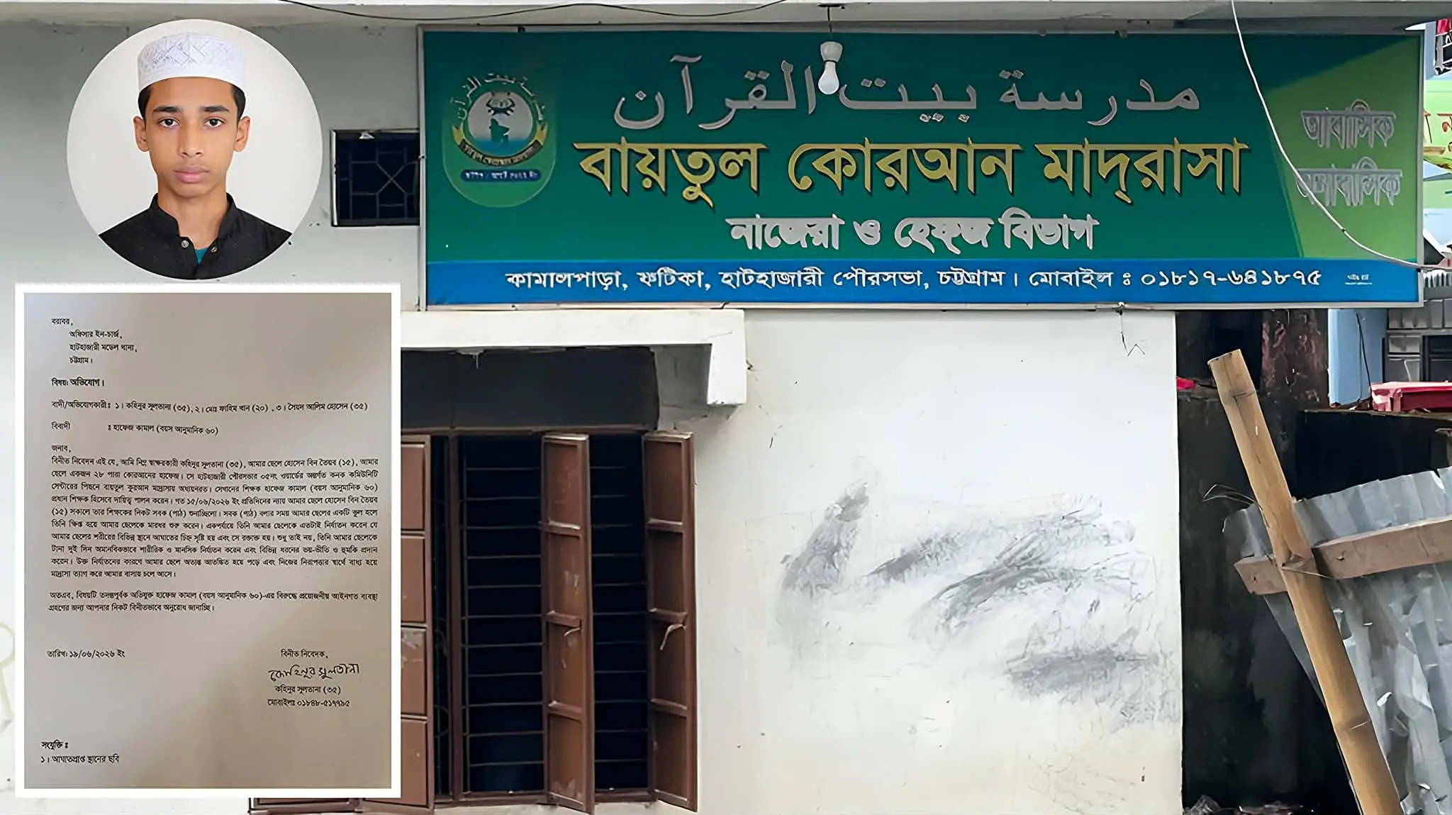 পাঠ ভুলের অভিযোগে শিশু হাফেজকে নির্মম নির্যাতন,প্রধান শিক্ষকের বিরুদ্ধে থানায় অভিযোগ