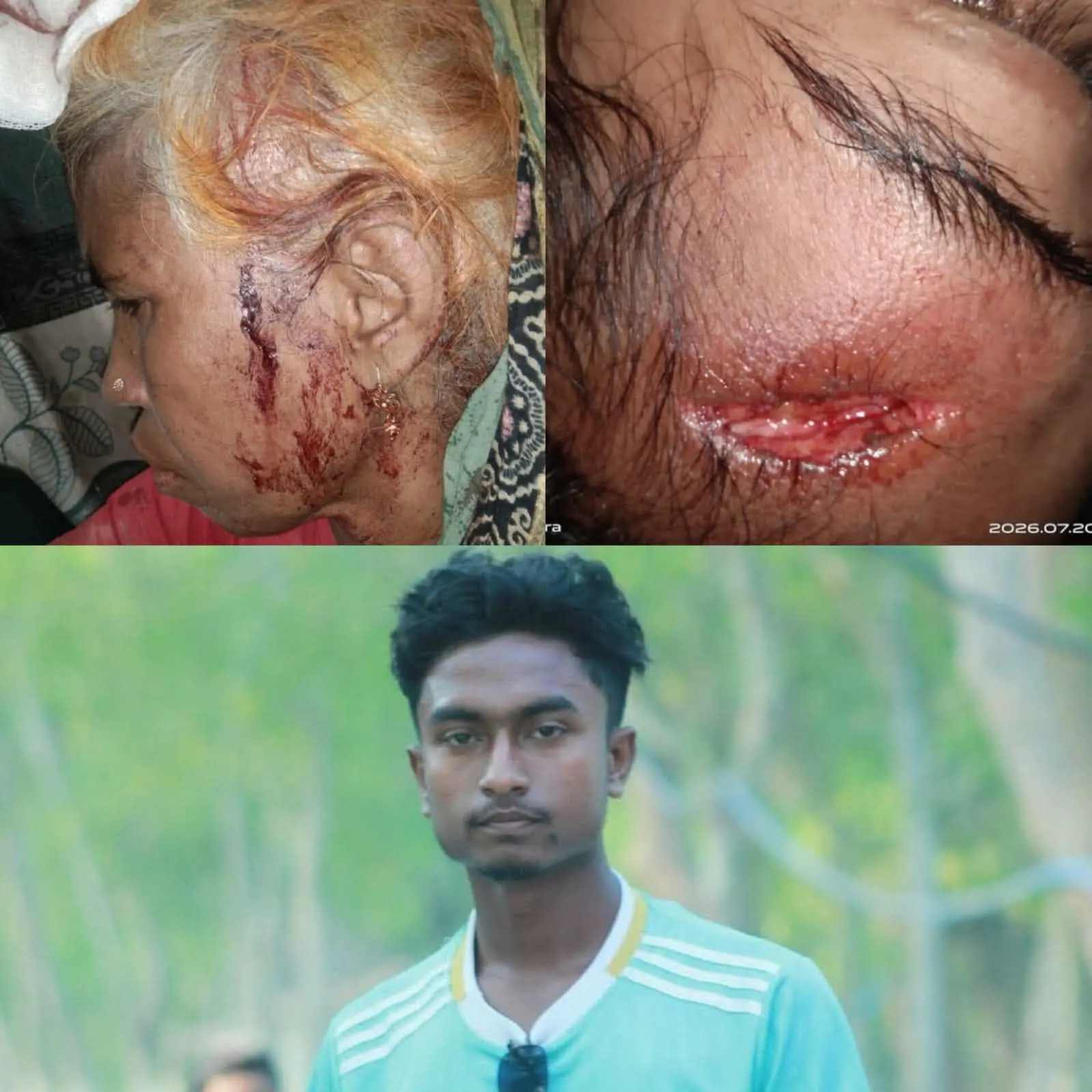 বাঁশখালীতে বিশ্বকাপ খেলা নিয়ে কথাকাটাকাটির জেরে হামলা, গুরুতর আহত মা-মেয়ে