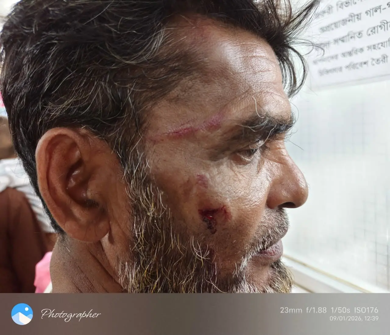 মাতামুহুরীতে দেশীয় অস্ত্র নিয়ে হামলা-লুটপাট, আহত ৬