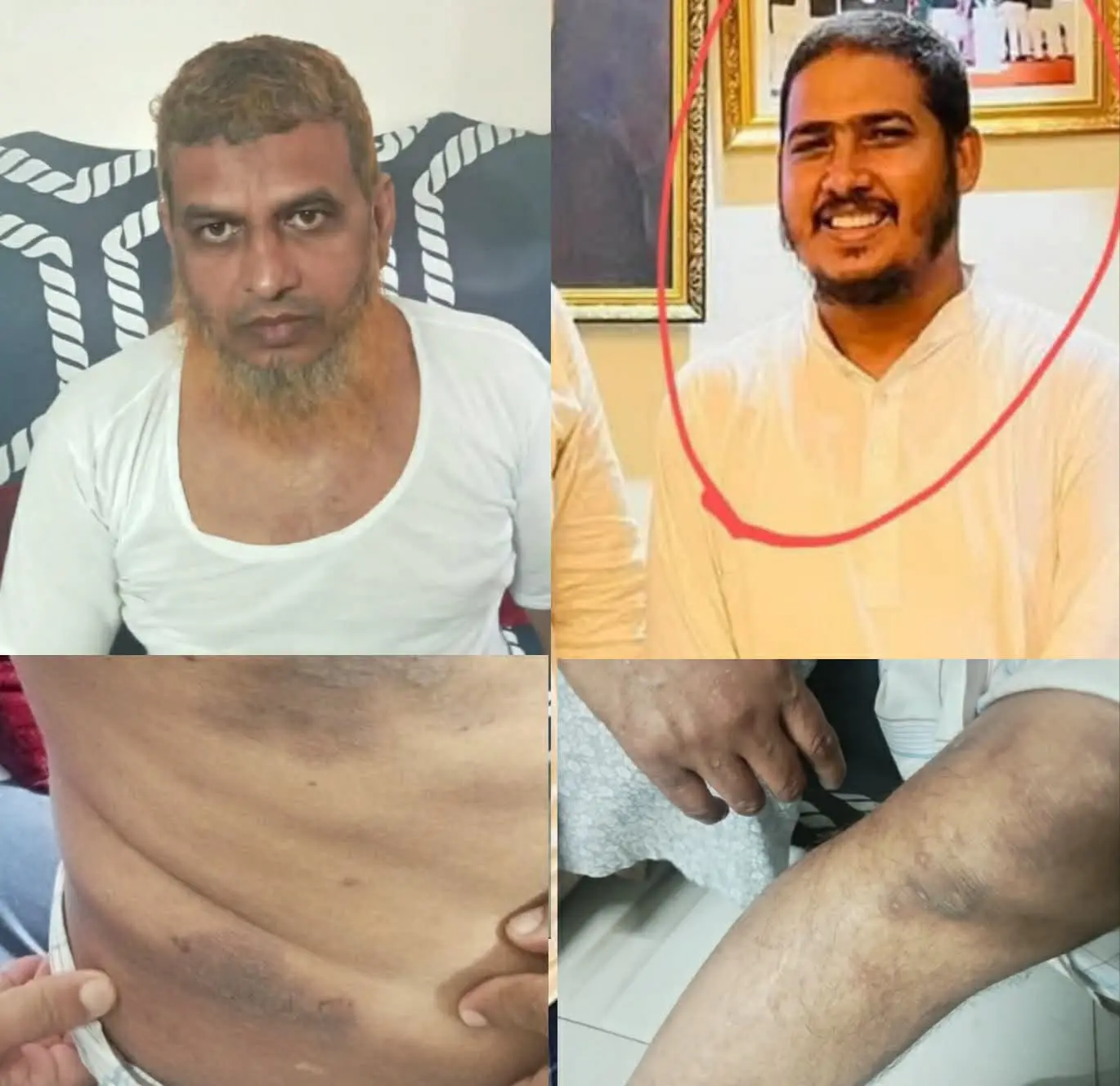 বাঁশখালীতে ছাত্রলীগ নেতার বিরুদ্ধে আলেমকে অপহরণ ও মারধরের অভিযোগ এলাকায় তীব্র ক্ষোভ