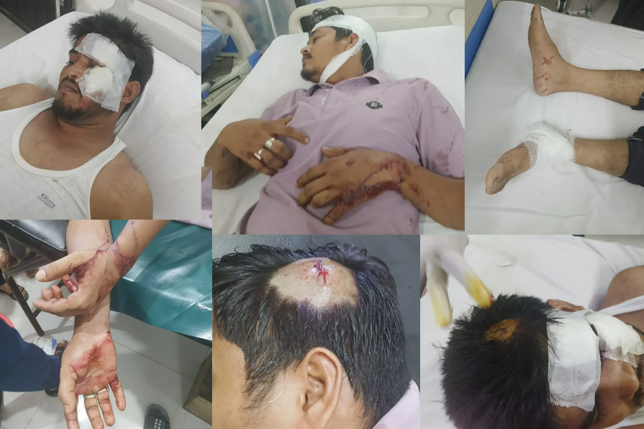 গরুর রশিতে পঁচিয়ে সিএনজি অটোরিকশা দুর্ঘটনা: মালিকপক্ষের হামলায় পুলিশের এএসআইসহ আহত ৪