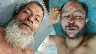 ইভটিজিং মামলায় জামিনে বেরিয়ে বাদীর ওপর হামলা, আহত ২