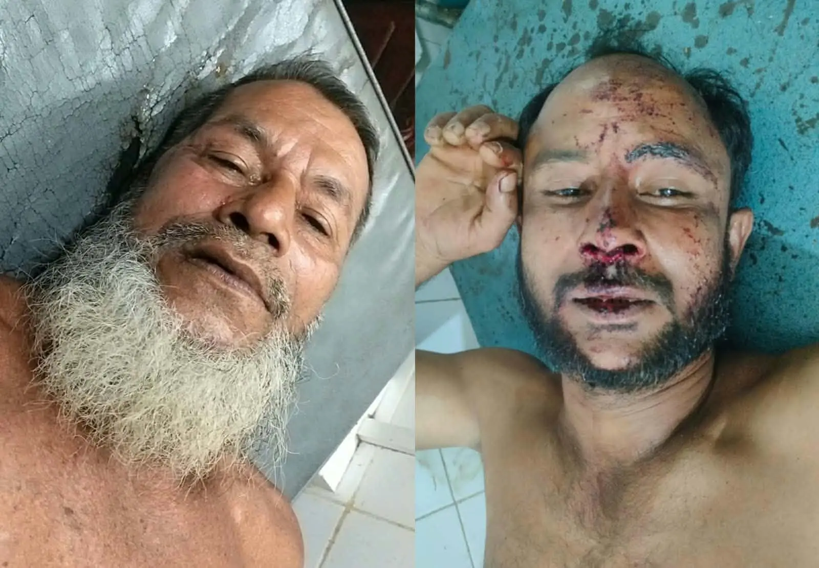 ইভটিজিং মামলায় জামিনে বেরিয়ে বাদীর ওপর হামলা, আহত ২
