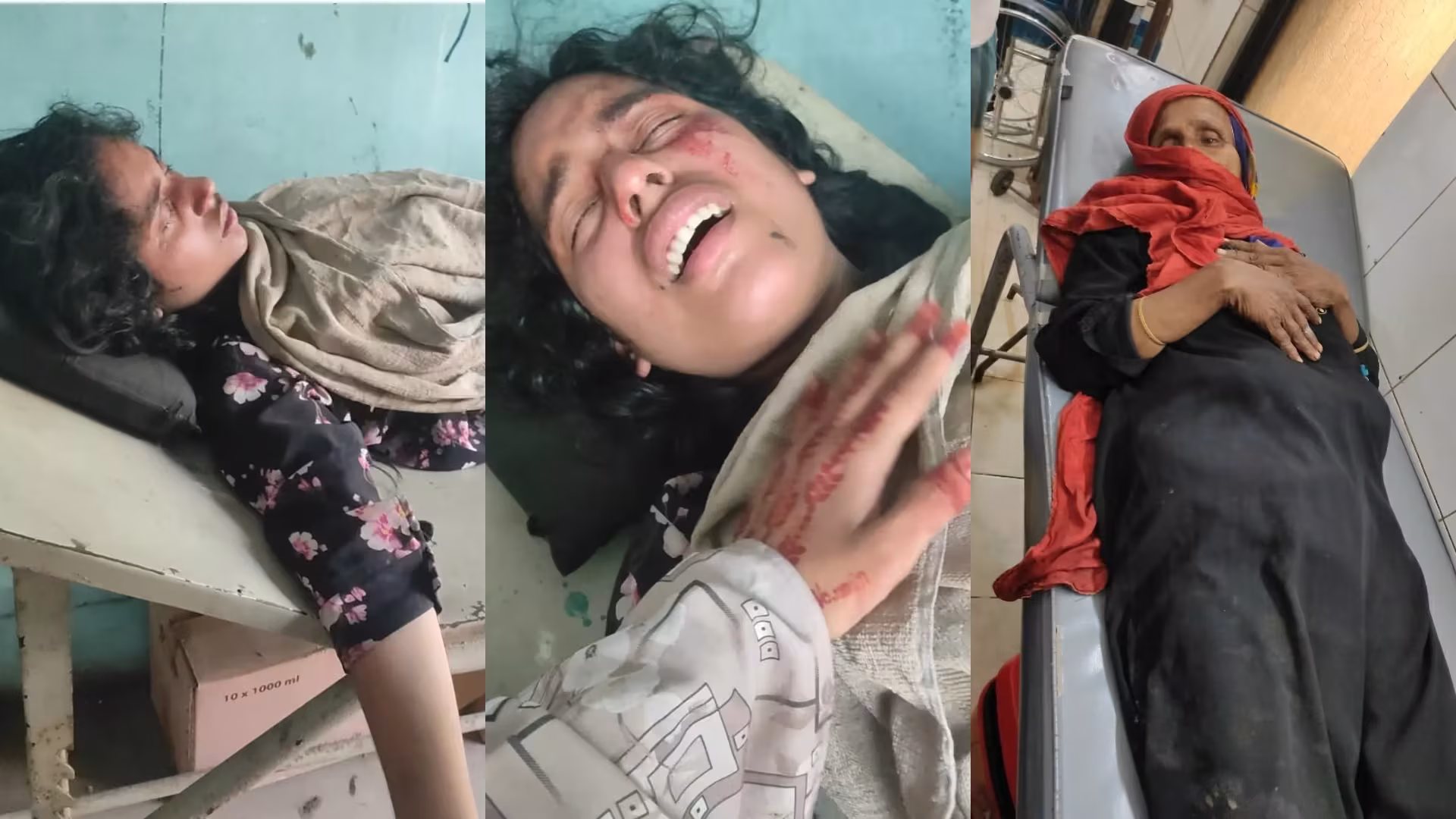 আনোয়ারায় গ্রাম পুলিশের বাড়িতে হামলা,নারীসহ আহত ৪