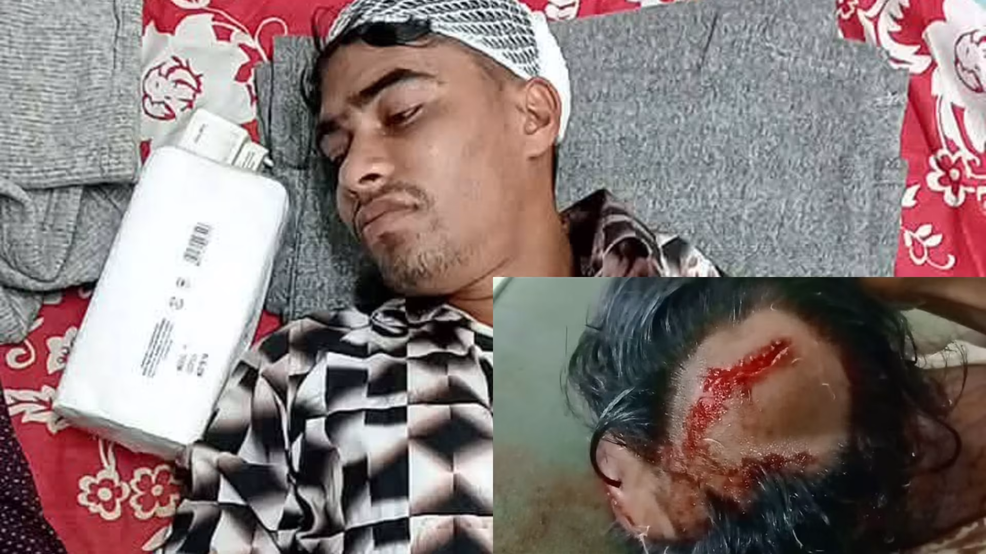 নাইক্ষ্যংছড়ির জামছড়িতে বহিরাগতদের হামলায় ছাত্রসহ আহত ৬, গ্রামবাসীর প্রতিবাদ
